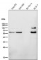 Anti-ER alpha ESR1 Rabbit Monoclonal Antibody